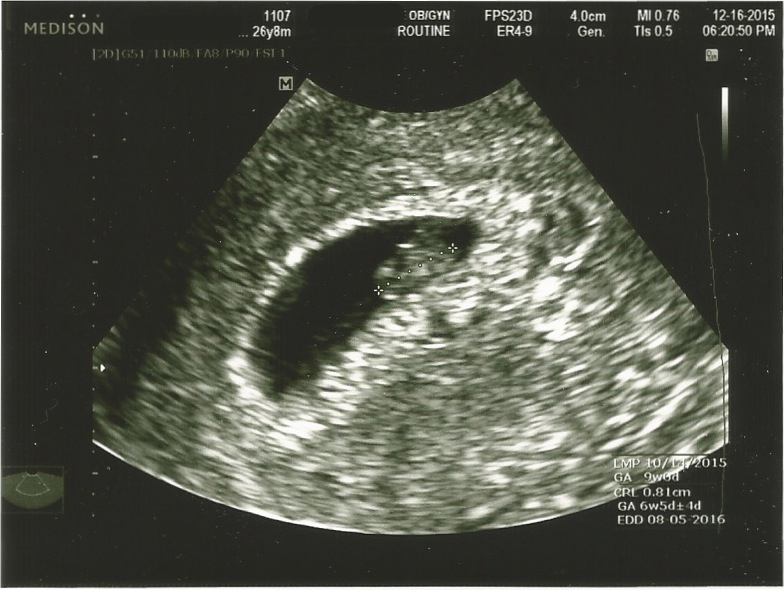 Meet my baby!